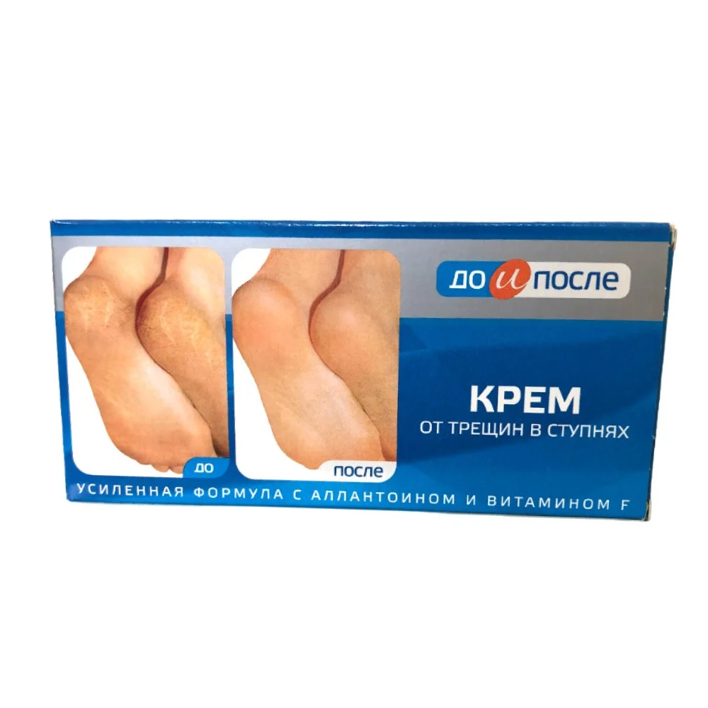 Крем от трещин в ступнях серии "До и после" 150мл №1